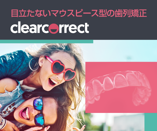 マウスピース矯正